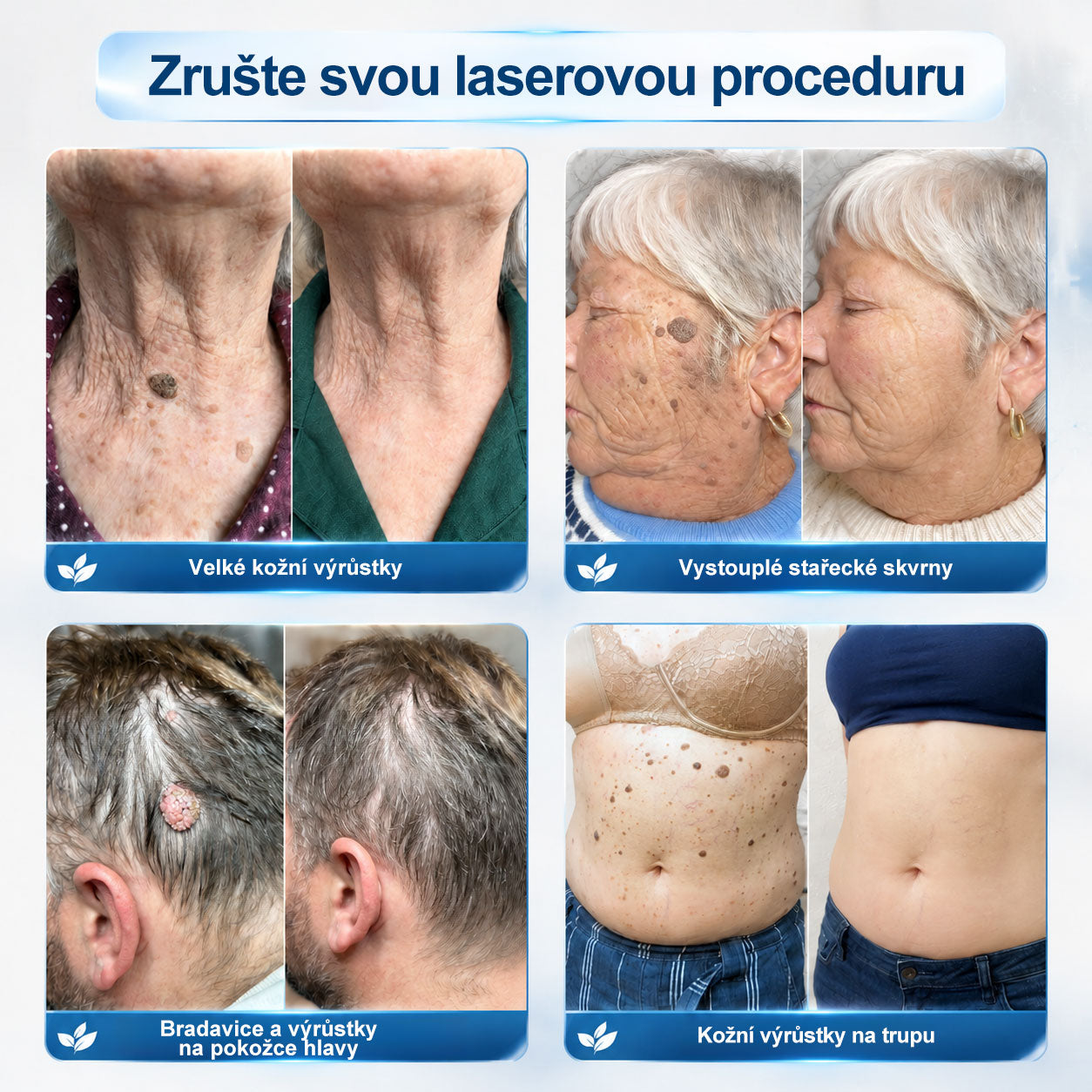 Oficiální značkový obchod |🖊️𝐏𝐢𝐜𝑑𝑜® 𝟩𝖽𝖾𝗻𝗻í 𝘰𝘥𝘴𝘵𝗋𝖺ň𝗈𝗏𝖺č 𝒔𝒌𝒗𝒓𝙣 𝙖 𝙥𝙞𝙜𝙢𝙚𝙣𝙩𝘰𝘷ý𝘤𝘩 𝘴𝘬𝖛𝖗𝖓 (Bezbolestný rollerball bez jizev)🌷