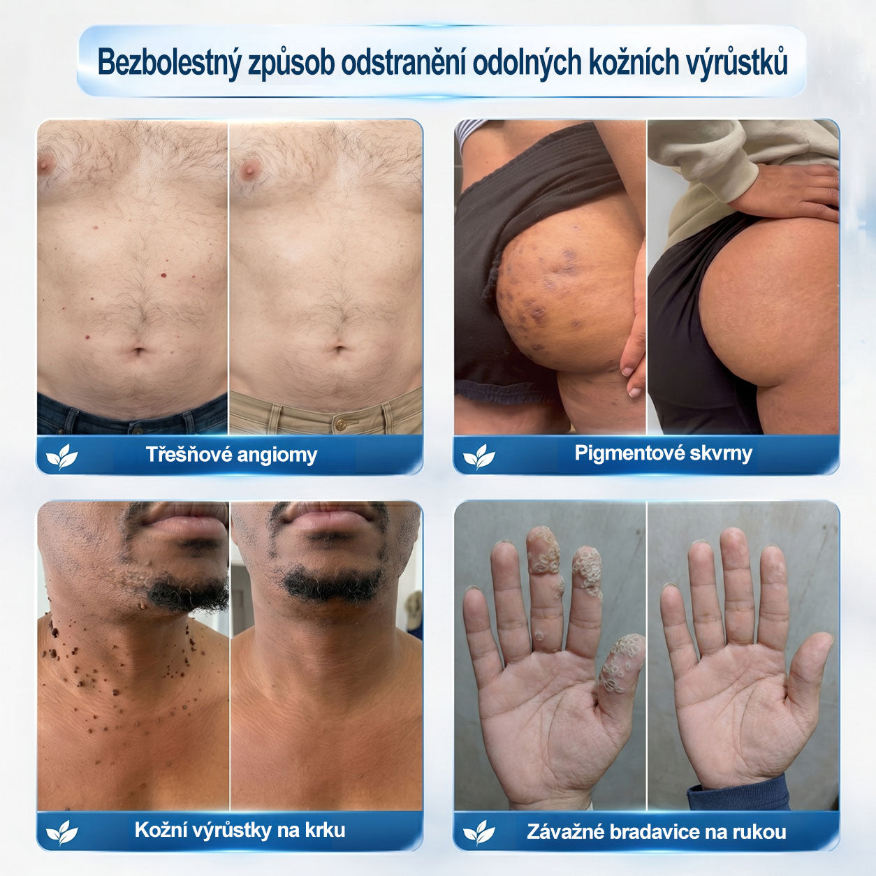 Oficiální značkový obchod |🖊️𝐏𝐢𝐜𝑑𝑜® 𝟩𝖽𝖾𝗻𝗻í 𝘰𝘥𝘴𝘵𝗋𝖺ň𝗈𝗏𝖺č 𝒔𝒌𝒗𝒓𝙣 𝙖 𝙥𝙞𝙜𝙢𝙚𝙣𝙩𝘰𝘷ý𝘤𝘩 𝘴𝘬𝖛𝖗𝖓 (Bezbolestný rollerball bez jizev)🌷