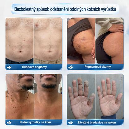 Oficiální značkový obchod |🖊️𝐏𝐢𝐜𝑑𝑜® 𝟩𝖽𝖾𝗻𝗻í 𝘰𝘥𝘴𝘵𝗋𝖺ň𝗈𝗏𝖺č 𝒔𝒌𝒗𝒓𝙣 𝙖 𝙥𝙞𝙜𝙢𝙚𝙣𝙩𝘰𝘷ý𝘤𝘩 𝘴𝘬𝖛𝖗𝖓 (Bezbolestný rollerball bez jizev)🌷