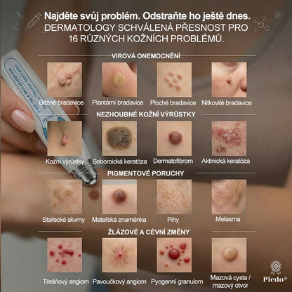 Oficiální značkový obchod |🖊️𝐏𝐢𝐜𝑑𝑜® 𝟩𝖽𝖾𝗻𝗻í 𝘰𝘥𝘴𝘵𝗋𝖺ň𝗈𝗏𝖺č 𝒔𝒌𝒗𝒓𝙣 𝙖 𝙥𝙞𝙜𝙢𝙚𝙣𝙩𝘰𝘷ý𝘤𝘩 𝘴𝘬𝖛𝖗𝖓 (Bezbolestný rollerball bez jizev)🌷