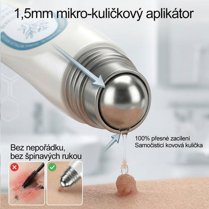 Oficiální značkový obchod |🖊️𝐏𝐢𝐜𝑑𝑜® 𝟩𝖽𝖾𝗻𝗻í 𝘰𝘥𝘴𝘵𝗋𝖺ň𝗈𝗏𝖺č 𝒔𝒌𝒗𝒓𝙣 𝙖 𝙥𝙞𝙜𝙢𝙚𝙣𝙩𝘰𝘷ý𝘤𝘩 𝘴𝘬𝖛𝖗𝖓 (Bezbolestný rollerball bez jizev)🌷