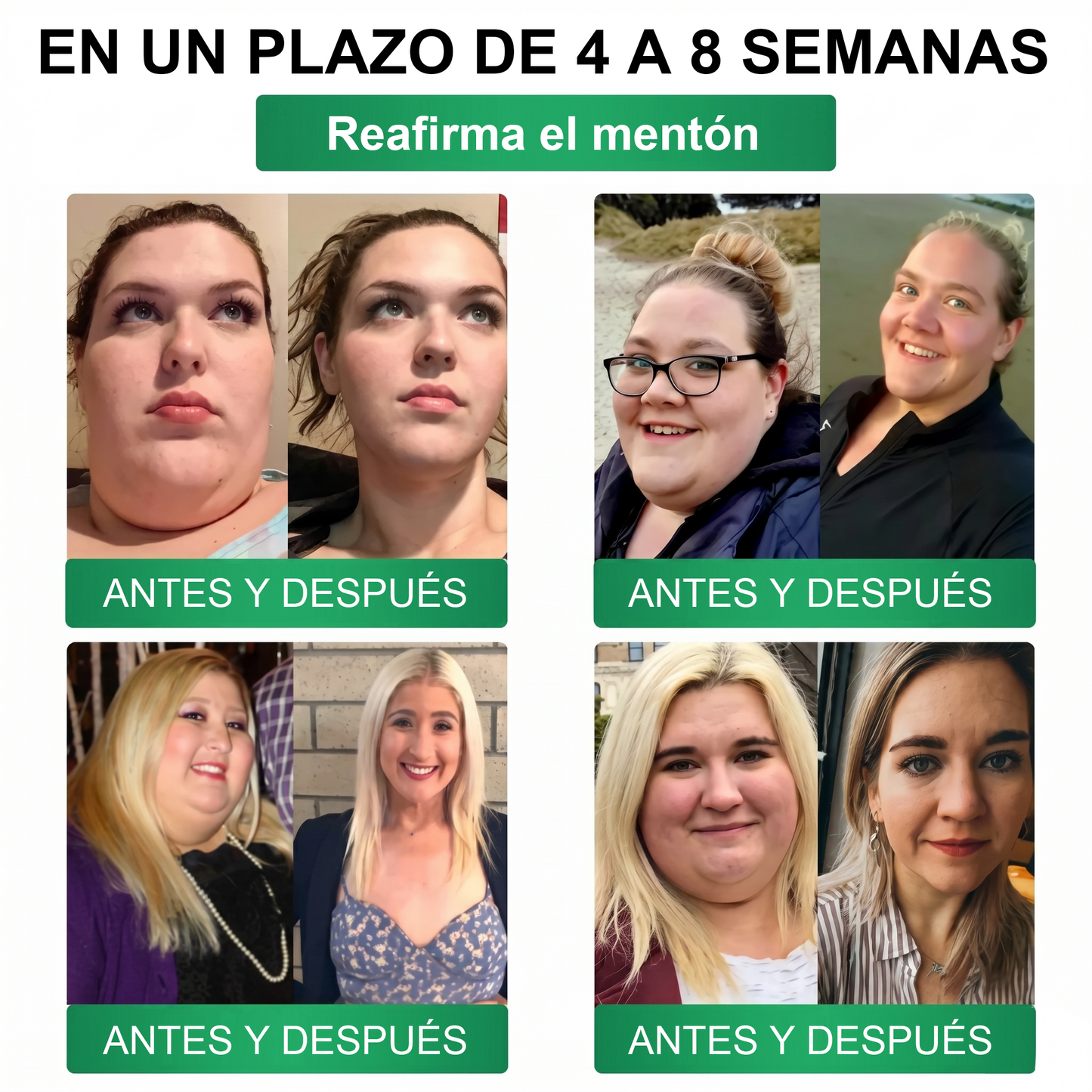 𝑻𝒊𝒆𝒏𝒅𝒂 𝑶𝒇𝒊𝒄𝒊𝒂𝒍 |🍵🍵𝐹𝑙𝑜𝑟𝑖𝑠𝑚𝑎® 10 𝑬𝑵 1 𝑴𝒐𝒓𝒊𝒏𝒈𝒂 𝒀 𝑩𝒆𝒓𝒃𝒆𝒓𝒊𝒏𝒂 𝑷𝒂𝒓𝒄𝒉𝒆 𝑨𝒗𝒂𝒏𝒛𝒂𝒅𝒐 𝑫𝒆 𝑴𝒊𝒄𝒓𝒐𝒏𝒆𝒆𝒅𝒍𝒆𝒔 𝑵𝒂𝒏𝒐 (𝑼𝒏𝒂 𝒗𝒆𝒛 𝒂𝒍 𝒅í𝒂, 𝒄𝒂𝒎𝒃𝒊𝒐𝒔 𝒗𝒊𝒔𝒊𝒃𝒍𝒆𝒔 𝒆𝒏 7 𝒅í𝒂𝒔) ✅ 𝑶𝒃𝒆𝒔𝒊𝒅𝒂𝒅, 𝑫𝒊𝒂𝒃𝒆𝒕𝒆𝒔, 𝑨𝒑𝒏𝒆𝒂 𝒅𝒆𝒍 𝑺𝒖𝒆ñ𝒐 𝒚 𝑷𝒓𝒐𝒃𝒍𝒆𝒎𝒂𝒔 𝑨𝒓𝒕𝒊𝒄𝒖𝒍𝒂𝒓𝒆𝒔