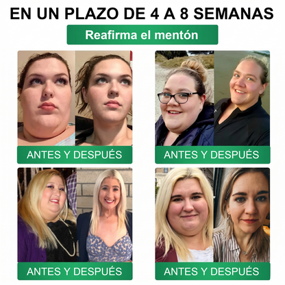𝑻𝒊𝒆𝒏𝒅𝒂 𝑶𝒇𝒊𝒄𝒊𝒂𝒍 |🍵🍵𝐹𝑙𝑜𝑟𝑖𝑠𝑚𝑎® 10 𝑬𝑵 1 𝑴𝒐𝒓𝒊𝒏𝒈𝒂 𝒀 𝑩𝒆𝒓𝒃𝒆𝒓𝒊𝒏𝒂 𝑷𝒂𝒓𝒄𝒉𝒆 𝑨𝒗𝒂𝒏𝒛𝒂𝒅𝒐 𝑫𝒆 𝑴𝒊𝒄𝒓𝒐𝒏𝒆𝒆𝒅𝒍𝒆𝒔 𝑵𝒂𝒏𝒐 (𝑼𝒏𝒂 𝒗𝒆𝒛 𝒂𝒍 𝒅í𝒂, 𝒄𝒂𝒎𝒃𝒊𝒐𝒔 𝒗𝒊𝒔𝒊𝒃𝒍𝒆𝒔 𝒆𝒏 7 𝒅í𝒂𝒔) ✅ 𝑶𝒃𝒆𝒔𝒊𝒅𝒂𝒅, 𝑫𝒊𝒂𝒃𝒆𝒕𝒆𝒔, 𝑨𝒑𝒏𝒆𝒂 𝒅𝒆𝒍 𝑺𝒖𝒆ñ𝒐 𝒚 𝑷𝒓𝒐𝒃𝒍𝒆𝒎𝒂𝒔 𝑨𝒓𝒕𝒊𝒄𝒖𝒍𝒂𝒓𝒆𝒔
