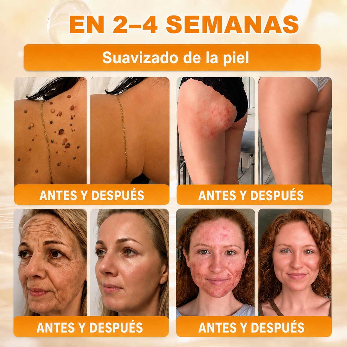 🔥🔥𝐓𝐢𝐞𝐧𝐝𝐚 𝐨𝐟𝐢𝐜𝐢𝐚𝐥 • 𝐅𝐚𝐛𝐫𝐢𝐜𝐚𝐝𝐨 𝐞𝐧 𝐄𝐬𝐩𝐚ñ𝐚 🍈𝗗𝗼𝗿𝗺𝗼𝗿𝗻𝗮® 𝗩𝗲𝗻𝗲𝗻𝗼 𝗱𝗲 𝗮𝗯𝗲𝗷𝗮 𝗖𝗿𝗲𝗺𝗮 𝗶𝗻𝘁𝗲𝗴𝗿𝗮𝗹 🌟Ú𝐋𝐓𝐈𝐌𝐎 𝐃Í𝐀 – 𝟖𝟎 % 𝐃𝐄 𝐃𝐄𝐒𝐂𝐔𝐄𝐍𝐓𝐎